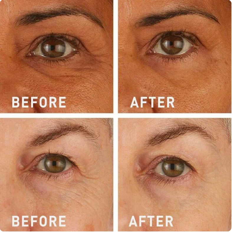 Instant FIRMx Temporary Eye Tightener | Firm and Smooth the Look of Fine Lines